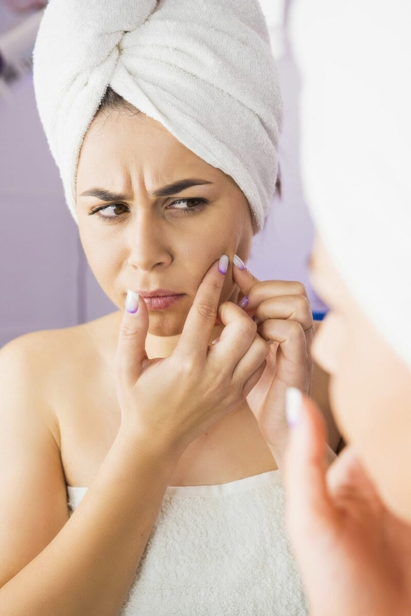 Is Hyaluronic Acid Good For Acne Healthier Steps